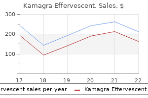 buy kamagra effervescent 100mg on-line