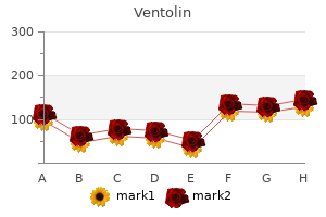 buy ventolin cheap