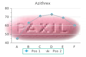 purchase cheap azithrex on-line