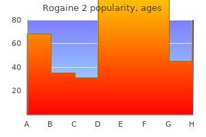 buy rogaine 2 from india