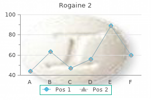 order 60ml rogaine 2 visa