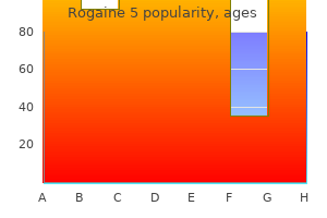 cheap rogaine 5 60 ml fast delivery