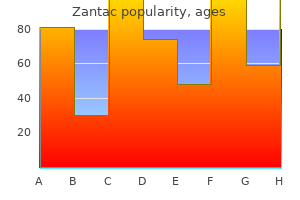 zantac 300 mg on line