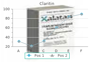 generic claritin 10 mg with visa