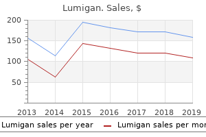 purchase cheap lumigan line