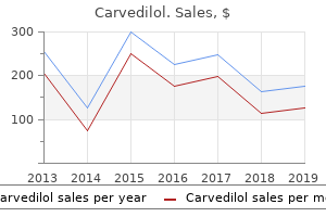 buy 12.5 mg carvedilol with mastercard