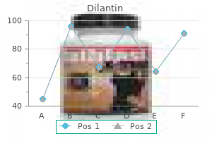 100 mg dilantin fast delivery