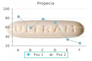 discount propecia 5mg without a prescription