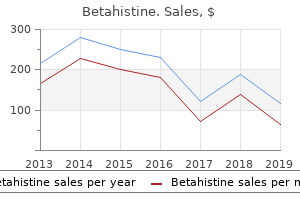 purchase 16mg betahistine visa