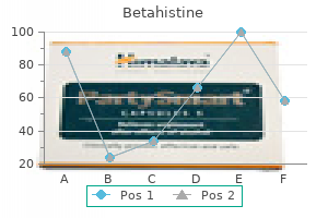 cheap betahistine amex