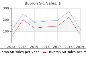 buy bupron sr 150 mg amex