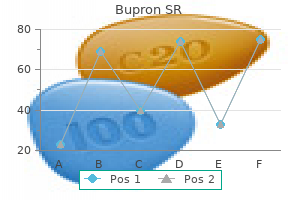 purchase bupron sr 150mg on-line