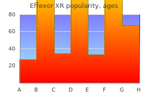 150mg effexor xr free shipping