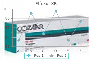 75mg effexor xr