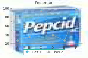 buy 70mg fosamax with mastercard