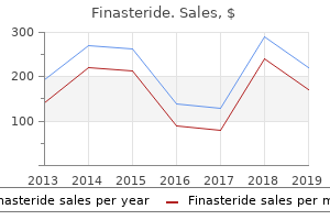 cheap finasteride 1 mg line