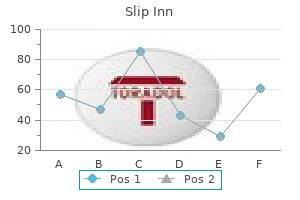 purchase slip inn american express