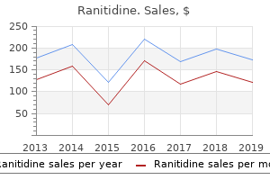 buy ranitidine line