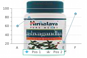 quality 300 mg ranitidine