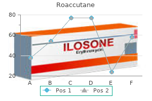 purchase 30mg roaccutane fast delivery