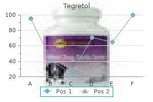 discount 100 mg tegretol otc