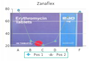 cheap zanaflex express