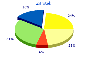 order 250mg zitrotek with mastercard