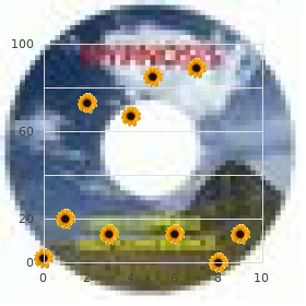 Facial dysmorphism macrocephaly myopia Dandy Walker type