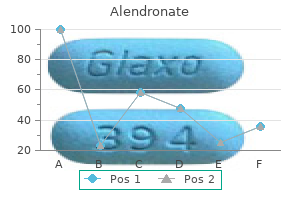 cheap 70mg alendronate mastercard