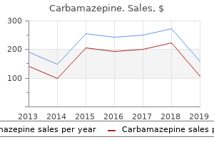 order generic carbamazepine on-line