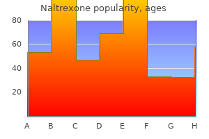 purchase on line naltrexone