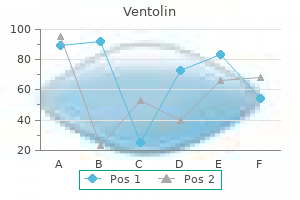 ventolin 100mcg free shipping