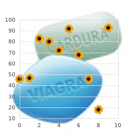 Hemifacial atrophy agenesis of the caudate nucleus